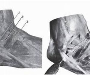 ﻿﻿﻿﻿Syndesmology